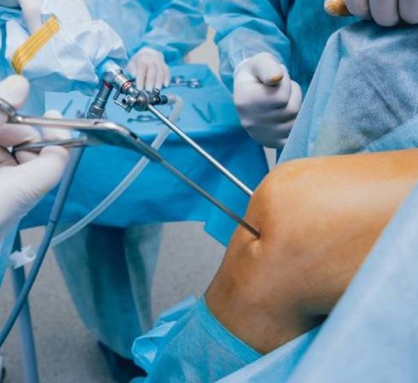 Arthroscopy Surgery
