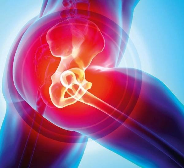 Hip Preservation